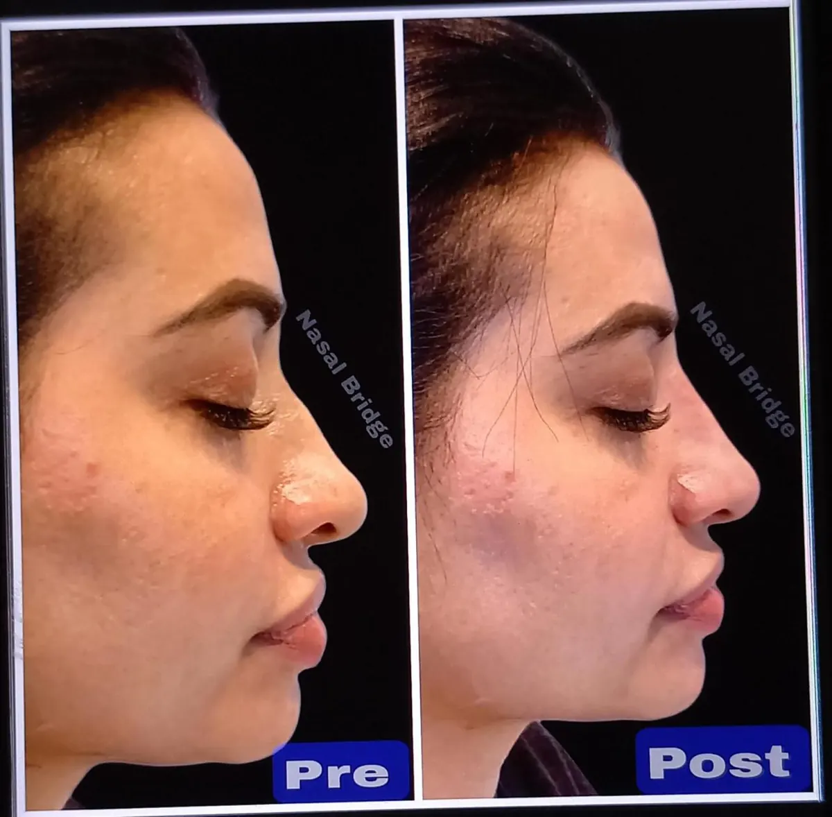 Real skin result at Image Clinic