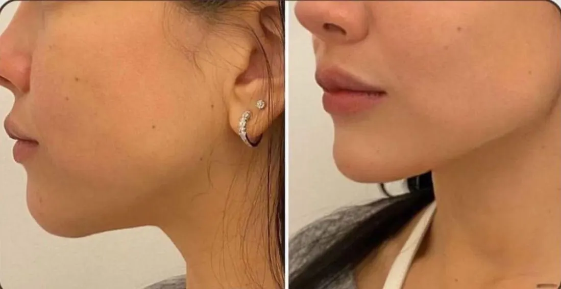 Real skin result at Image Clinic
