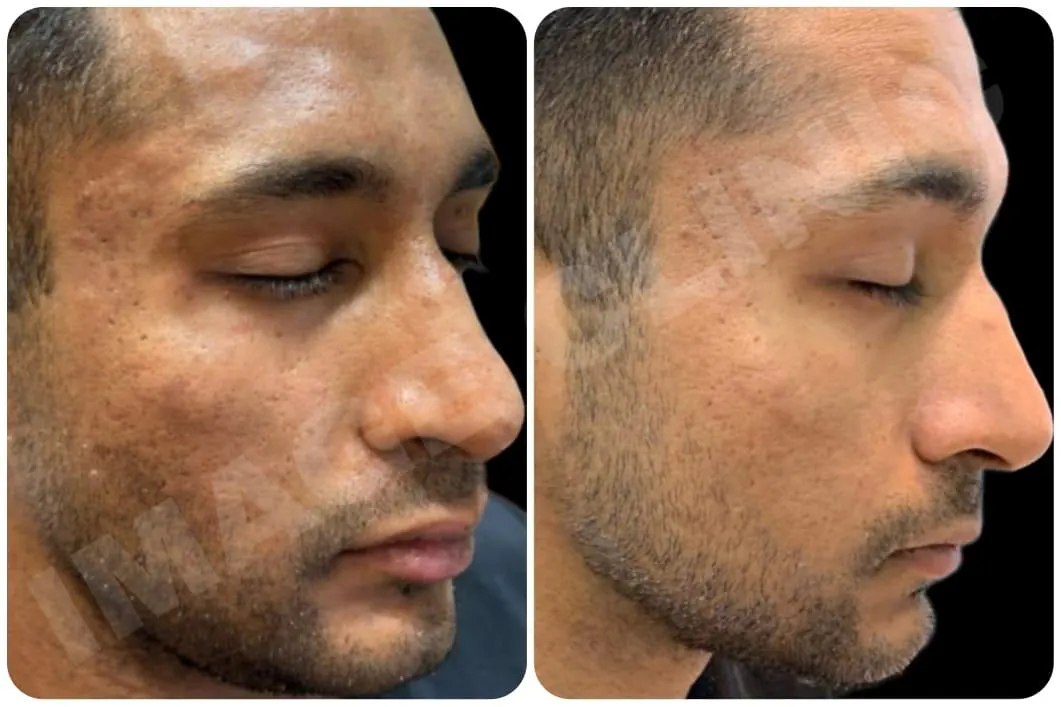 Real skin result at Image Clinic